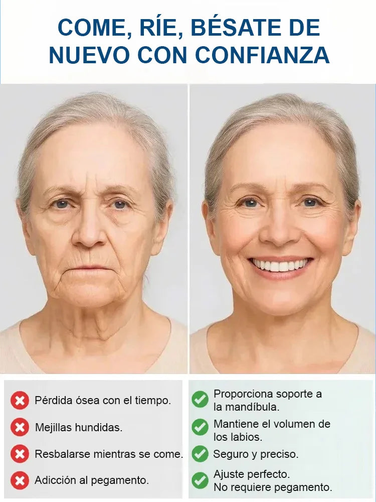 PROTESKIT – Prótesis Dental Completa con Soporte Esquelético (Sonrisa Firme y Natural) (Copia)