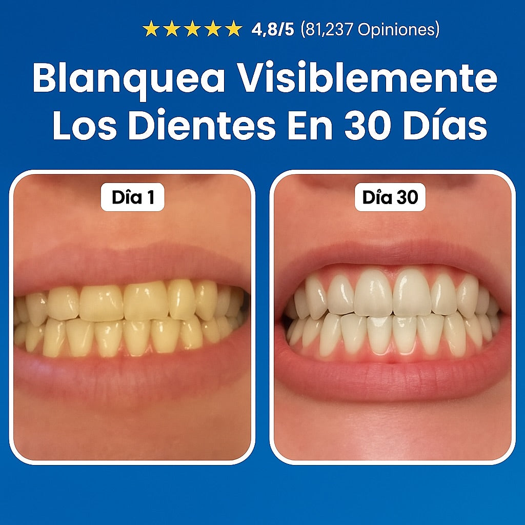 LapizDental® - REPARA CARIES, ALIVIA ENCÍAS INFLAMADAS + ENVÍO GRATIS