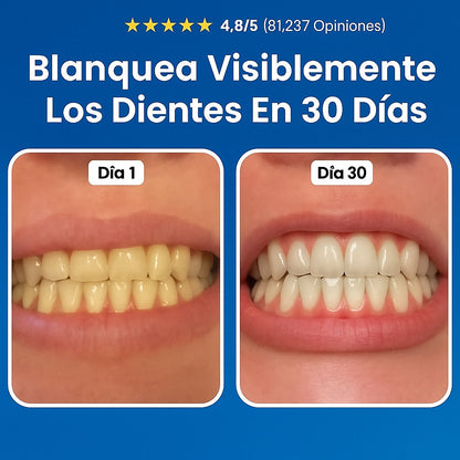 LapizDental® - REPARA CARIES, ALIVIA ENCÍAS INFLAMADAS + ENVÍO GRATIS