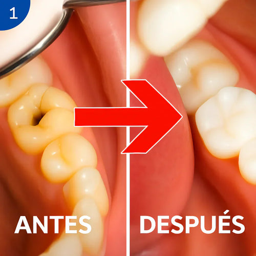 LapizDental® - REPARA CARIES, ALIVIA ENCÍAS INFLAMADAS + ENVÍO GRATIS